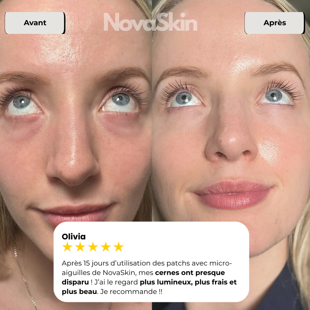 NovaSkin EyeLift™