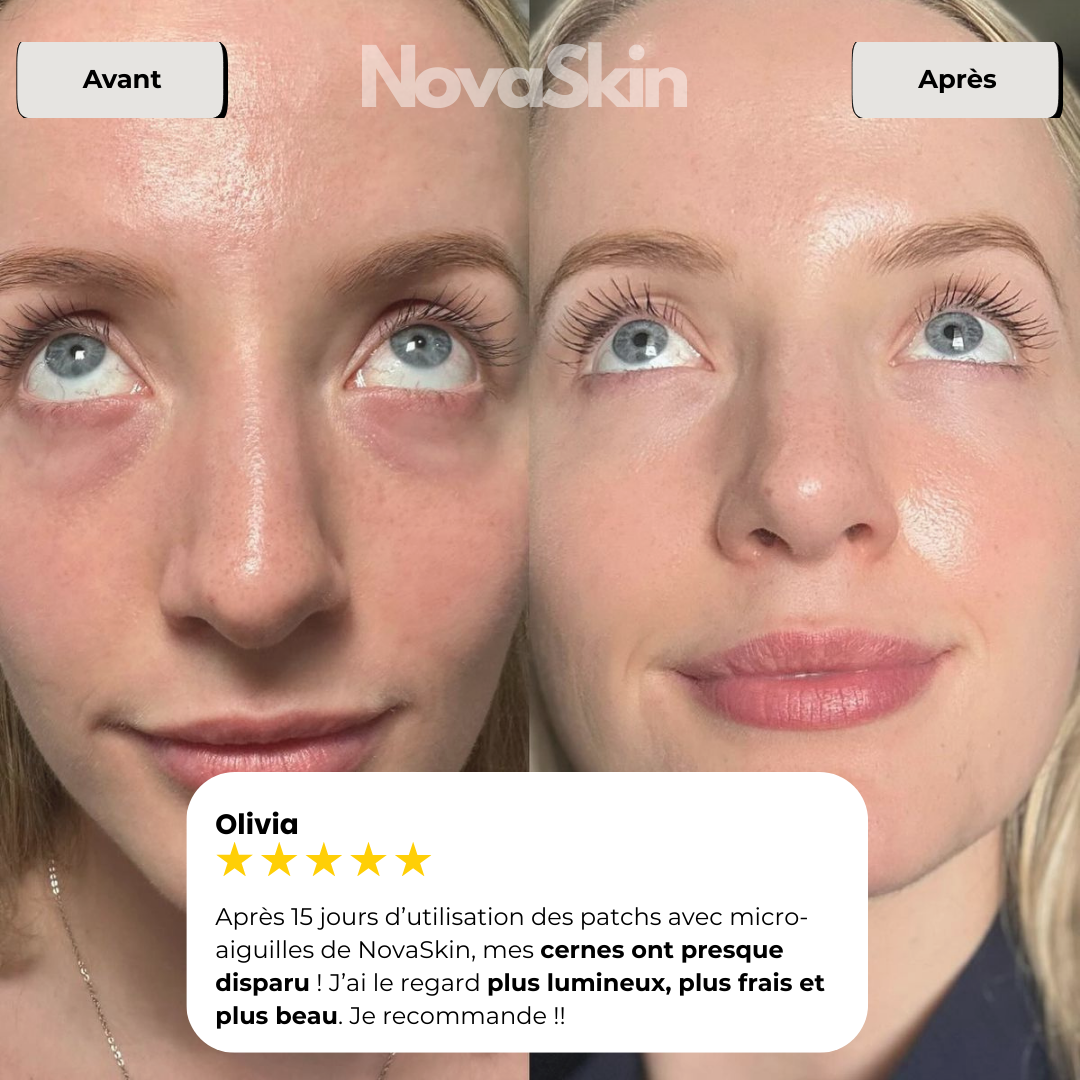 NovaSkin EyeLift™