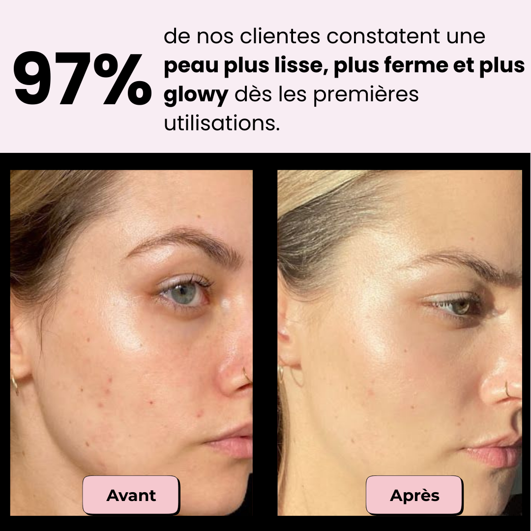 Gua Sha électrique - L’outil 4-en-1 qui transforme votre routine skincare