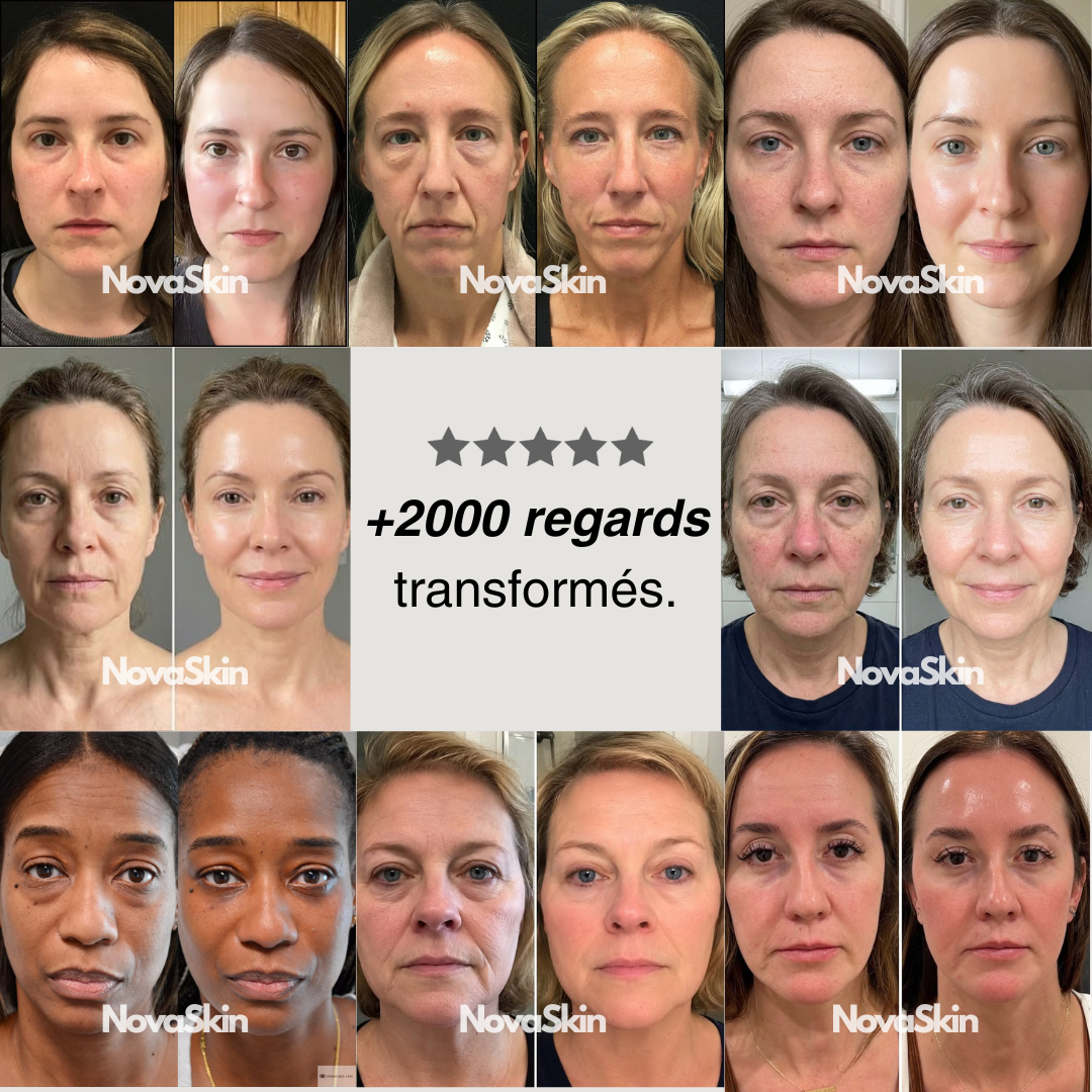 NovaSkin EyeLift™